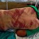 India-Kashmir-Violence-Hospital